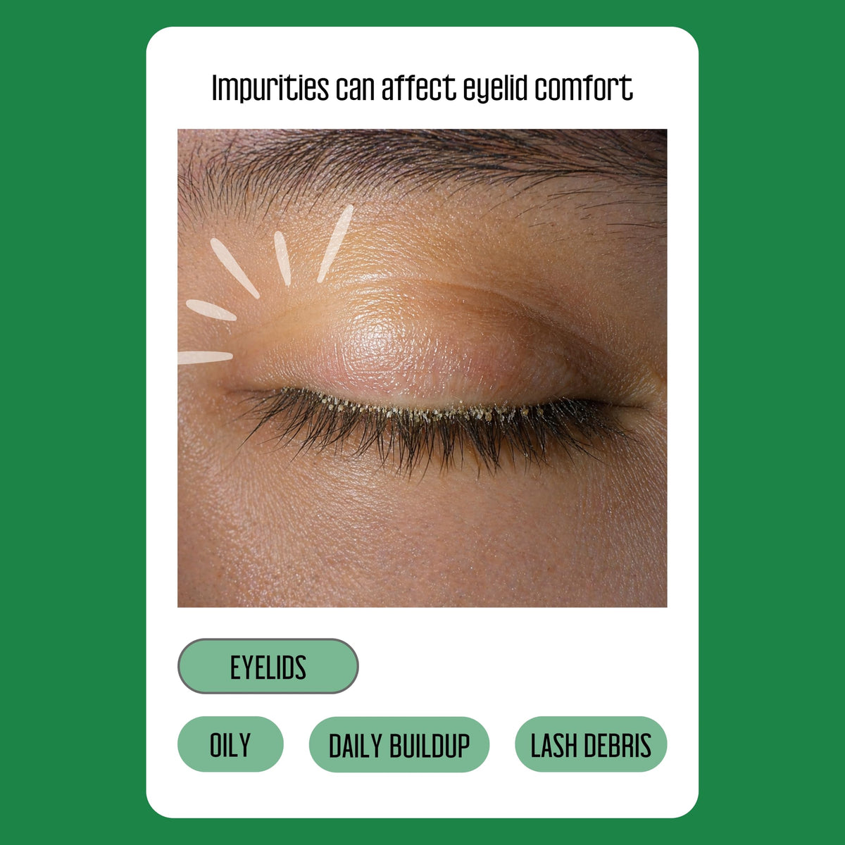 Premium imported tea tree eyelid wipes combat impurities for ultimate comfort. Experience fresh, clean eyelids daily.
