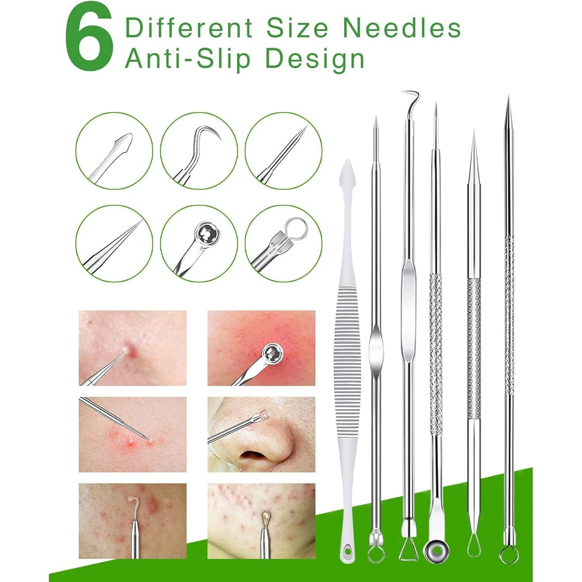 Explore our Blackhead Remover Tool Kit, featuring 6 anti-slip precision instruments. Verified by CuratCart for quality.
