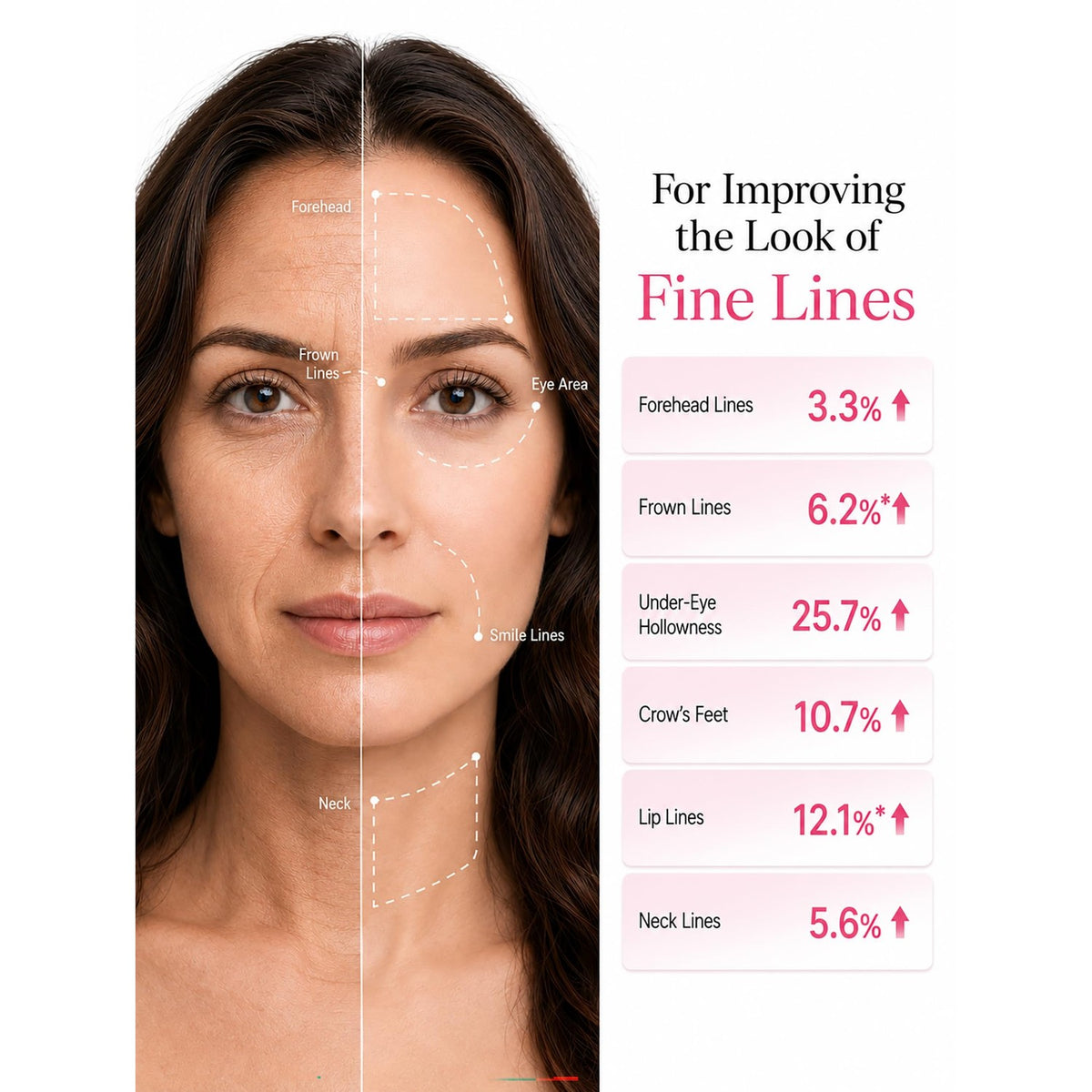 PDRN Pink Collagen Volume Balm showcases significant improvements in fine lines, enhancing skin quality for a youthful look. Available at Curat Cart.