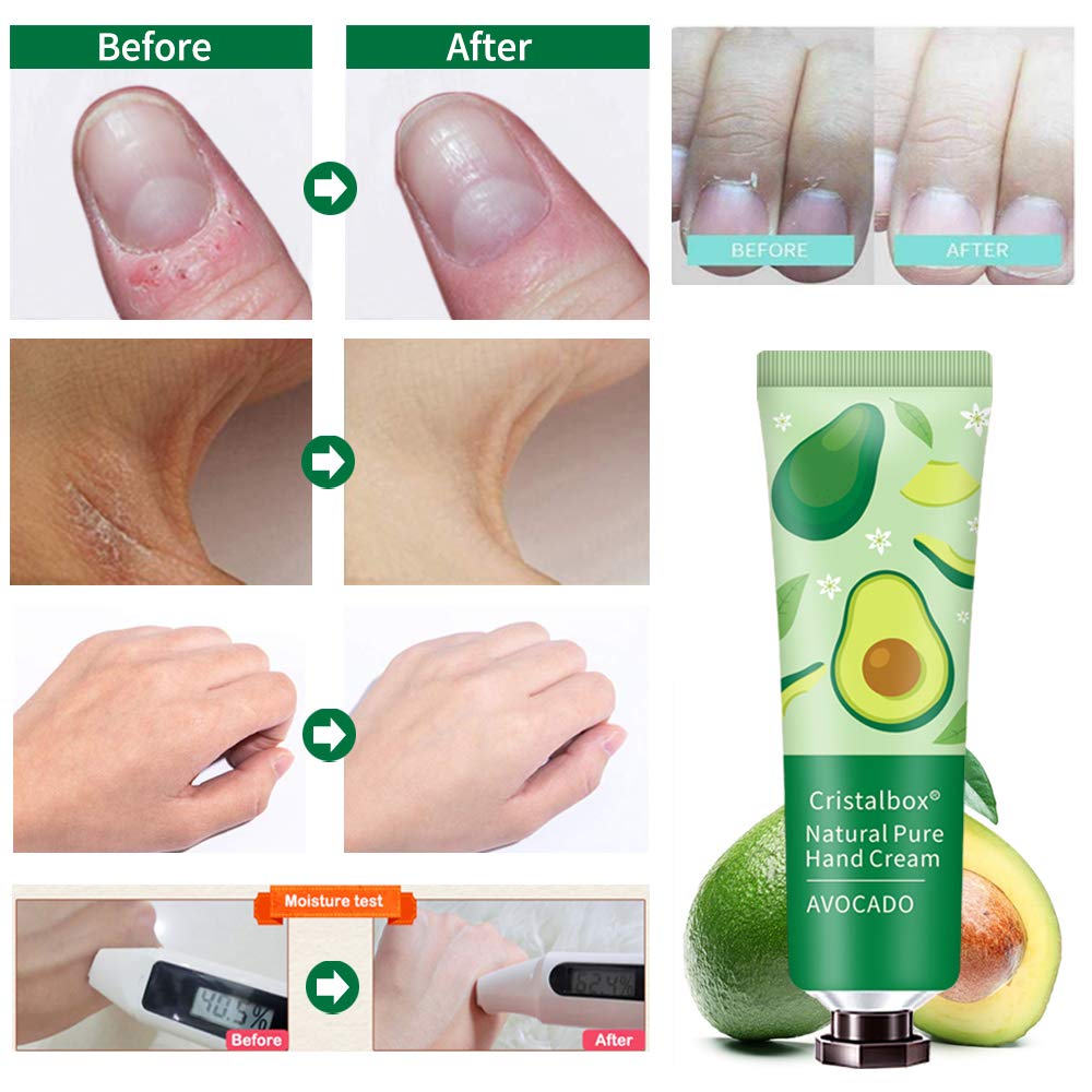 Experience the difference with Cristalbox hand cream. Imported avocado lotion revitalizes dry skin visibly.
