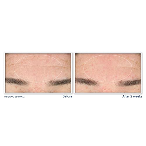 Buy now RoC Retinol Correxion Deep Wrinkle Serum Facial Cleanser with Niacinamide for Anti-Aging & Fine Lines, Makeup Remover, Ophthalmologist Tested Skin Care, 6 oz at indiglob india