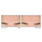 Buy now RoC Retinol Correxion Deep Wrinkle Serum Facial Cleanser with Niacinamide for Anti-Aging & Fine Lines, Makeup Remover, Ophthalmologist Tested Skin Care, 6 oz at indiglob india