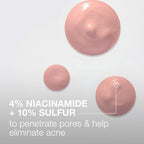 Buy now Neutrogena Stubborn Acne Spot Drying Lotion, Fragrance-Free Sulfur Acne Treatment Clears Acne By Drying Up & Shrinking Pimples, Paraben- & Oil-Free, 10% Sulfur & 4% Niacinamide, 1.0 fl. oz at indiglob india