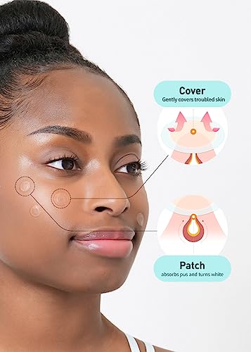 Buy now OLIVE YOUNG Care Plus Spot Patch Big (81 Count) | Hydrocolloid Patch, Spot Stickers for Acne Pimple and Zits at indiglob india