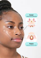 Buy now OLIVE YOUNG Care Plus Spot Patch Big (81 Count) | Hydrocolloid Patch, Spot Stickers for Acne Pimple and Zits at indiglob india