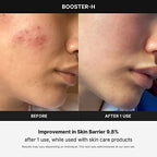 Buy now medicube Booster H - Korean Skincare Tool - Facial Glow Booster for Maximizing and Boosting Skin Care Absorption - Needle Free at indiglob india