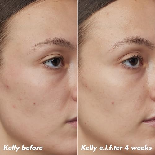 Buy now e.l.f. SKIN PLZ Clarify Facial Oil, Face Oil For Treating & Preventing Acne, Helps Calm Redness, Made with Salicylic Acid, Vegan & Cruelty-Free, 1 oz at indiglob india