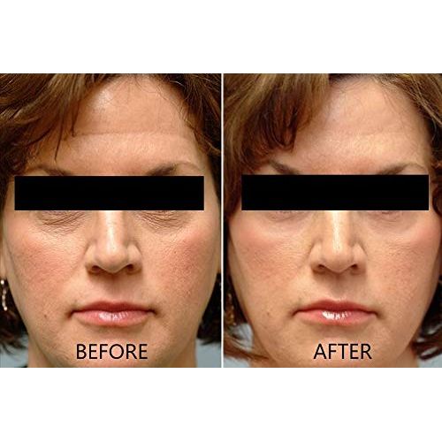 Buy now Vitamin C Serum 20% Pure L-Ascorbic Acid, Ferulic Acid, Vitamin E and Hyaluronic Acid for Face and Eyes Natural Anti Aging Anti Wrinkle 1oz. by Dr. Brenner at indiglob india