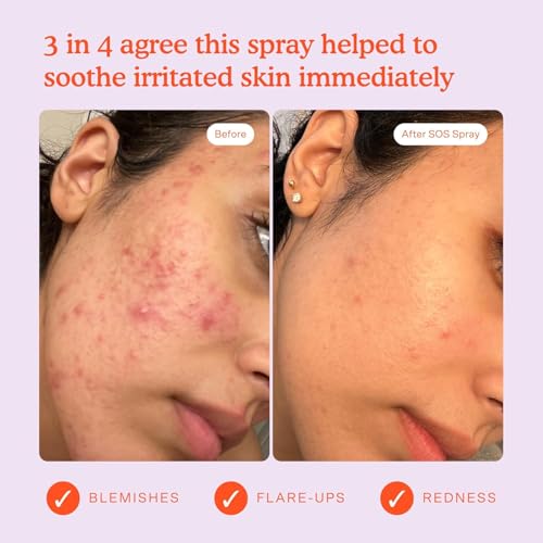 Buy now Tower 28 SOS Daily Rescue Facial Spray - Hypochlorous Acid Spray to Help Reduce Redness, Calm Irritation + Alleviate Flare-Ups - Purifying Travel Size Face Toner - Everyday Skin Care Essential (1 oz) at indiglob india