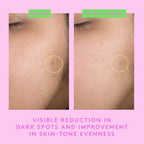 Buy now Drunk Elephant B-Goldi Bright Drops - 30 ml/1 fl oz - Illuminating Color Serum Drops - Clean Clinical Skincare - Cruelty-Free - Dermatologist-Tested - Free of Essential Oils, Silicones, and Fragrance at indiglob india