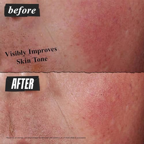 Buy now Kiehl's Ultra Facial Advanced Repair Barrier Cream, Intensive Treatment Relieves Dry + Sensitive Skin, Rapidly Reduces Redness and Soothes, Fast-Absorbing Breathable Formula, Paraben-Free - 1.7 fl oz at indiglob india