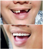 Buy now Instant Smile Comfort Fit Flex Natural Shade at indiglob india