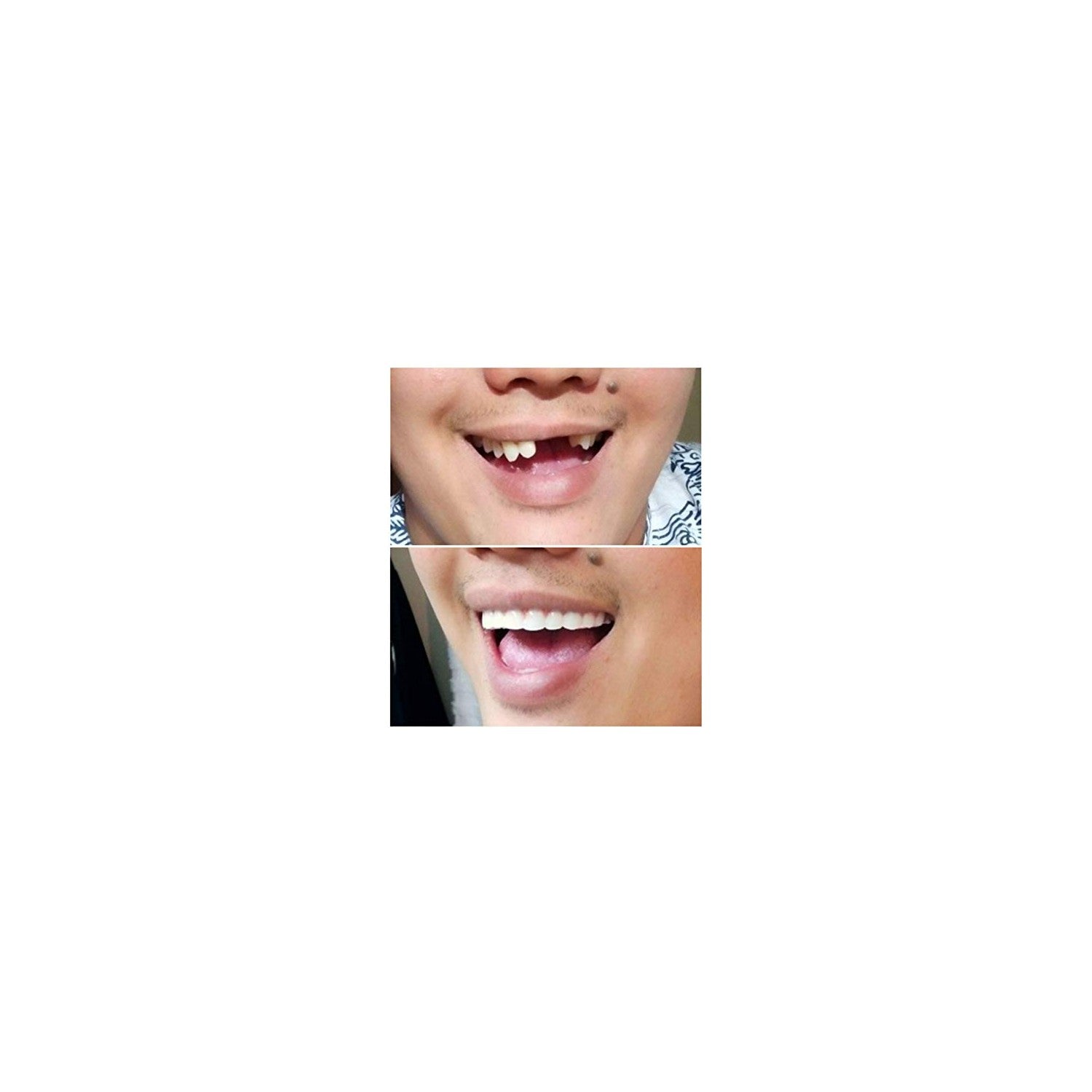 Buy now Instant Smile Comfort Fit Flex Natural Shade at indiglob india