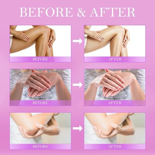 Buy now Dark Spot Corrector Cream - Underarm, Neck, Armpit, Knees, Elbows, Private Areas, Intimate Areas - Upgraded Formula, Instant Result 2 fl.oz at indiglob india