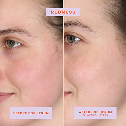Buy now Tower 28 SOS Rescue Face Serum - Soothing Facial Serum with Hypochlorous Acid for Irritated, Sensitive Skin - Gently Helps Reduce Redness + Blemishes - Fragrance-Free Everyday Skin Care (2 oz) at indiglob india