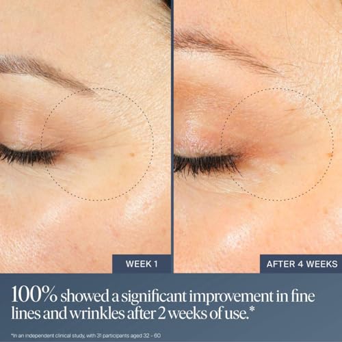 Buy now Summer Fridays Jet Lag Overnight Eye Serum - Nourishing Undereye Treatment for Dark Circles - Helps to Hydrate, Smooth, Firm & Depuff - Enriched with Glycerin to Lock in Moisture (0.5 Fl Oz) at indiglob india