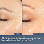 Buy now Summer Fridays Jet Lag Overnight Eye Serum - Nourishing Undereye Treatment for Dark Circles - Helps to Hydrate, Smooth, Firm & Depuff - Enriched with Glycerin to Lock in Moisture (0.5 Fl Oz) at indiglob india
