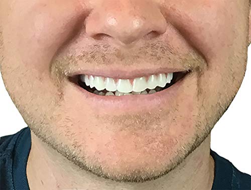 Buy now Instant Smile Comfort Fit Flex Natural Shade at indiglob india