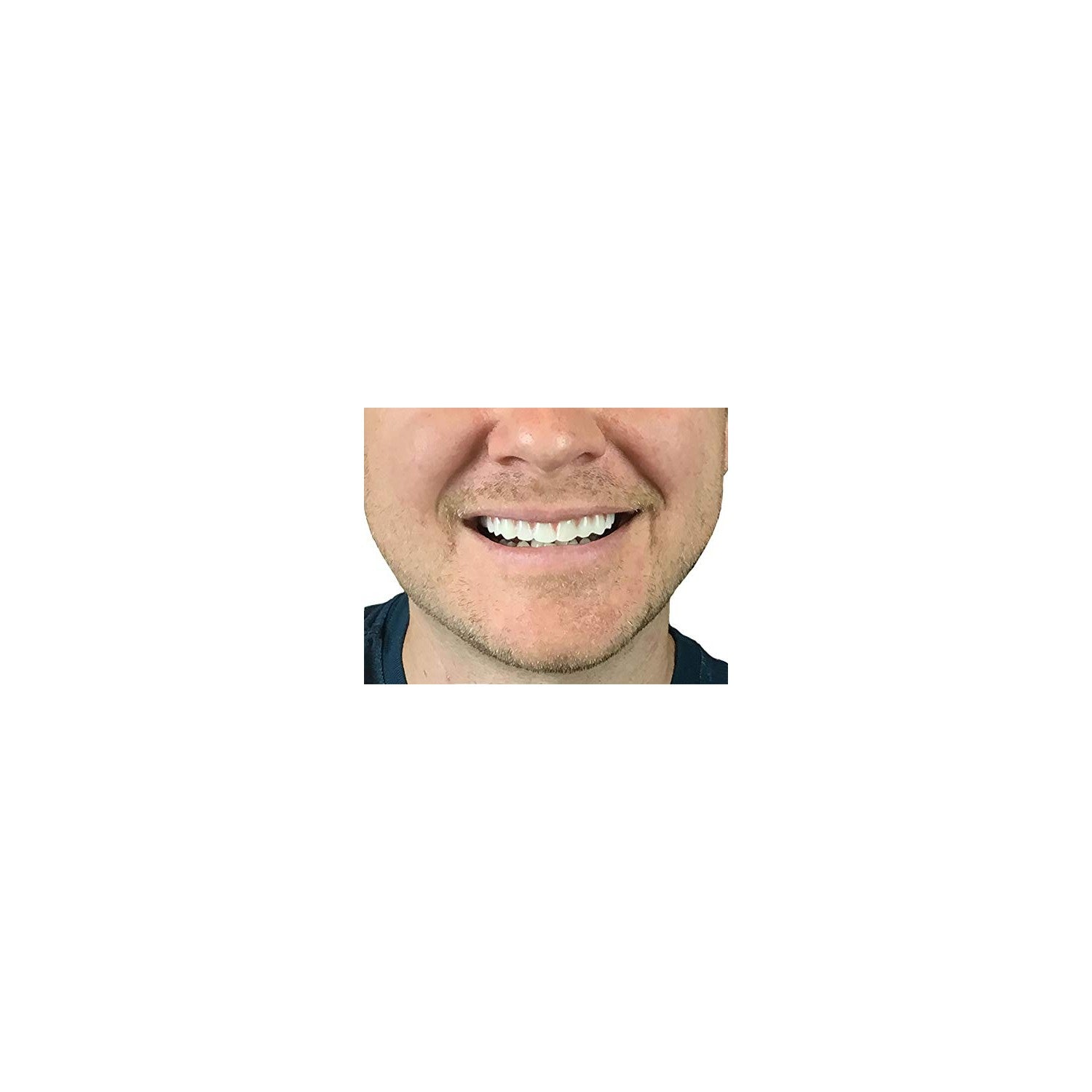 Buy now Instant Smile Comfort Fit Flex Natural Shade at indiglob india