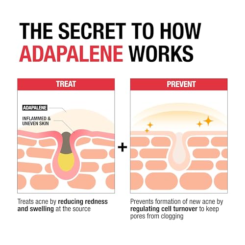 Buy now Neutrogena 0.1% Adapalene Gel Acne Treatment, Topical for Acne, Adapalene Medication for Blemishes, Once Daily Topical Retinoid to Prevent Breakouts, Oil & Fragrance-Free, 1.6 oz at indiglob india