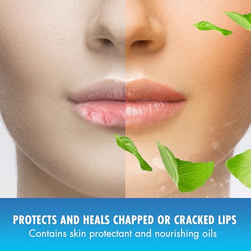 Buy now Mentholatum Natural Ice Original Medicated Lip Balm, Hydrating Lip Care for Dry, Chapped Lips, Moisturizing Formula with SPF 15 Helps Prevent Sunburn, Protection for Smooth, Soft Lips (Pack of 12) at indiglob india