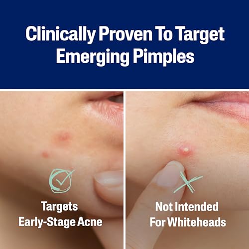 Buy now Cetaphil Acne Patches, Pimple Patches for Sensitive Skin, Formulated with Salicylic Acid, CICA, and Heartleaf Extract for Emerging Pimples, Visible Results in 6 Hours, 24 Count at indiglob india