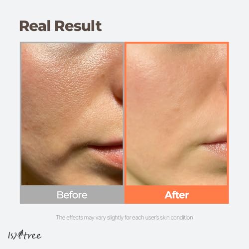 Buy now ISNTREE Green Tea Fresh Toner 200ml, 6.76 fl.oz | Korean Skincare | Toner for Oily Skin | Sebum Control | Hydrating and Refreshing at indiglob india