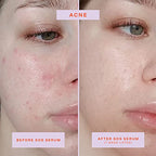 Buy now Tower 28 SOS Rescue Face Serum - Soothing Facial Serum with Hypochlorous Acid for Irritated, Sensitive Skin - Gently Helps Reduce Redness + Blemishes - Fragrance-Free Everyday Skin Care (2 oz) at indiglob india