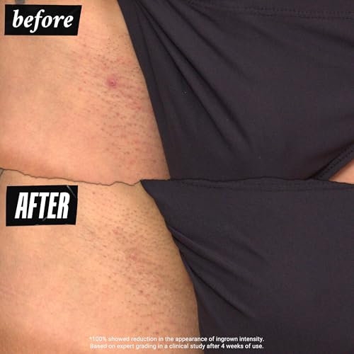 Buy now Kiehl's Since 1851 Ingrown Hair & Tone Correcting Drops - 30ml at indiglob india