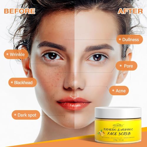 Buy now Vitamin C and Turmeric Face Scrub Cream Organics Microdermabrasion Facial Scrub Exfoliating Clears Blackheads Improve Dark Spot Acne with Strawberry Extract Exfoliator 130g/4.5oz at indiglob india