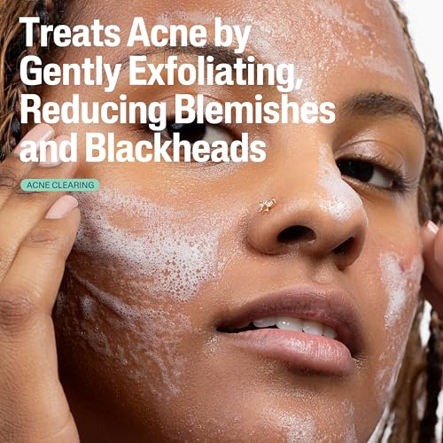 Buy now Cetaphil Gentle Clear Pore Clearing Acne Cleanser, Foaming Gel Cleanser for Sensitive, Acne-Prone Skin, 8 Fl Oz Pump Bottle, 2% Salicylic Acid, Gently Exfoliates, Dermatologist Recommended Brand at indiglob india
