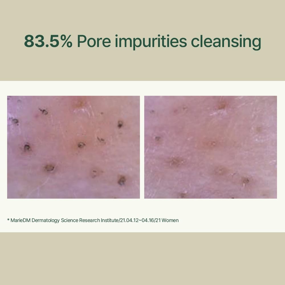 Buy now Pyunkang Yul PKY Calming Low pH Foaming Cleanser | Daily Face Wash & Makeup Remover with Tea Tree, Centella Asiatica, 5 Hyaluronic Acids that Removes Dead Skin Cells, Hydrates Skin - 150ml 5.07 Fl.Oz. at indiglob india