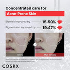 Buy now COSRX 15% Niacinamide Face Serum, 0.67 fl oz, Pore Minimizer Serum for Face, Even Skin Tone, Korean Skin Care at indiglob india