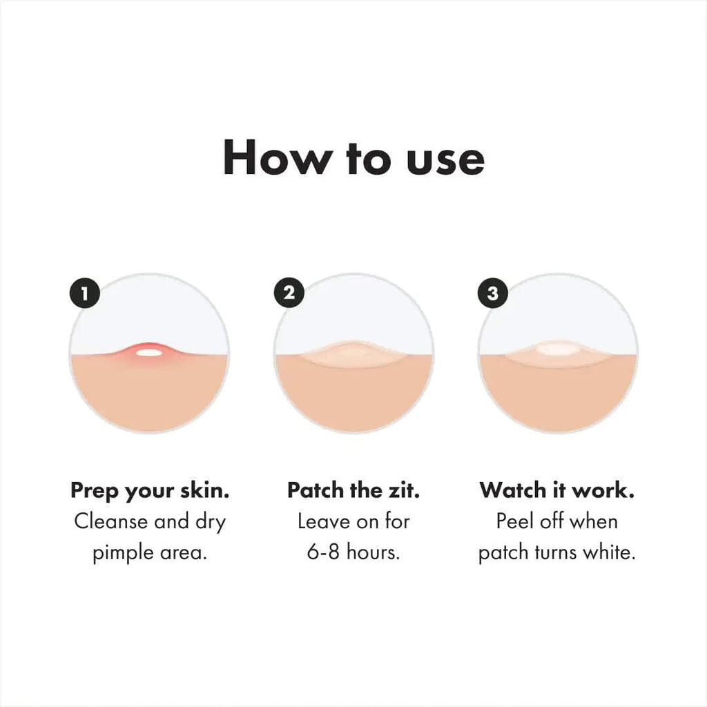 Mighty Patch Hero Cosmetics Variety Pack of Acne Pimple Patches, 26 Ct | Includes Original, Invisible+, XL Surface Patches; Hydrocolloid Patches; For Covering Zits and Blemishes; Korean Skin Care