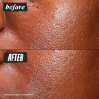 Buy now Kiehl's Ultra Pure High-Potency 5.0% Niacinamide Serum, Concentrated Face Serum for Oily Skin, Reduces Excess Oil and Shine, Helps Minimize Imperfections for a Natural Glow, Paraben-Free - 1 fl oz at indiglob india