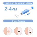 Skin Tag Remover Device Safe and Effective Skin Tag Removal Kits Home Use for Men & Women