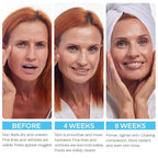 Buy now Retinol Cream for Face with Hyaluronic Acid, Day-Night Anti-Aging Moisturizer for Women, Men, Collagen Cream for Face Reduces Wrinkles, Dryness, 1.85 Oz at indiglob india