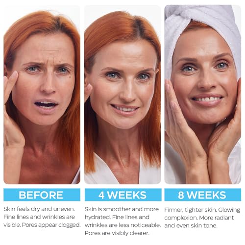 Buy now Retinol Cream for Face with Hyaluronic Acid, Day-Night Anti-Aging Moisturizer for Women, Men, Collagen Cream for Face Reduces Wrinkles, Dryness, 1.85 Oz at indiglob india