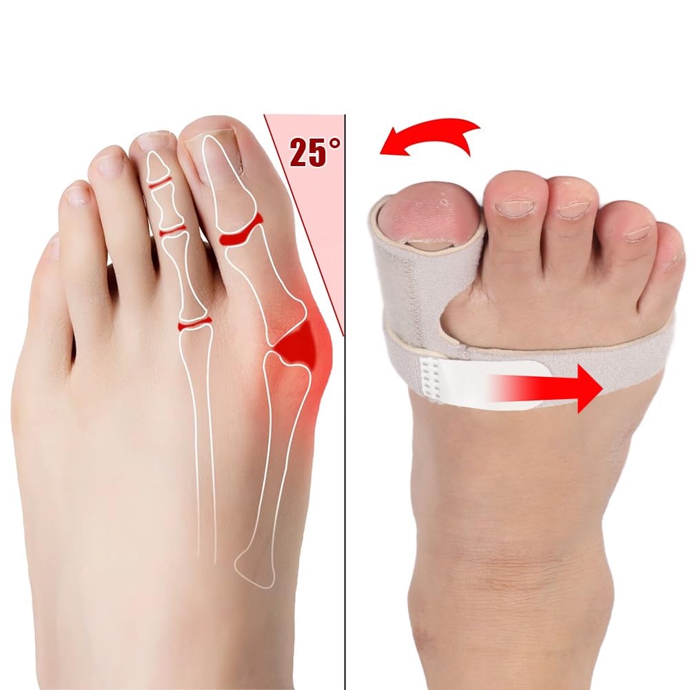 Joyzan Toe Brace Splint, Adjustable Orthopedic Big Toe Straightener Support