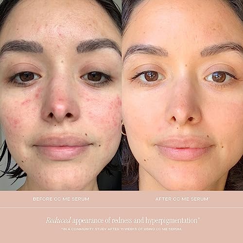 Buy now Summer Fridays CC Me Serum with Vitamin C + Niacinamide - Brightening + Hydrating Face Serum to Improve Skin Tone + Reduce Appearance of Dark Spots Over Time (1 Fl Oz) at indiglob india