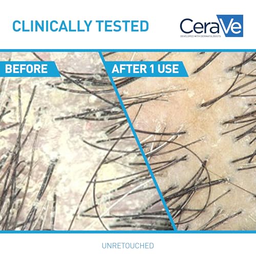 Buy now CeraVe Hydrating Anti Dandruff Shampoo, 1% Pyrithione Zinc Dandruff Treatment With Ceramides, Niacinamide & Hyaluronic Acid, Helps Eliminate Flakes & Provides Itchy Scalp Relief, Sulfate Free, 12 Oz at indiglob india