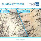 Buy now CeraVe Hydrating Anti Dandruff Shampoo, 1% Pyrithione Zinc Dandruff Treatment With Ceramides, Niacinamide & Hyaluronic Acid, Helps Eliminate Flakes & Provides Itchy Scalp Relief, Sulfate Free, 12 Oz at indiglob india