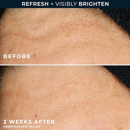 Buy now RoC Multi Correxion Revive + Glow Gel Vitamin C Cleanser, Face Wash, Facial Cleanser with Glycolic Acid, Paraben-Free, Sulfate-Free Skin Care - 6 Ounces at indiglob india