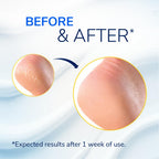 Dr. Scholl's Severe Cracked Heel Repair Restoring Balm 2.5oz, with 25% Urea for Dry, Cracked Feet, Heals and Moisturizes for Healthy Feet