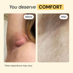 MyMagicHealer Universal Flare Care – Solution for Everyday Skin Flare-Ups | Drawing Salve for Boils & Cysts, Hidradenitis Suppurativa, Folliculitis | Irritated Skin and Chafing Relief 1 oz