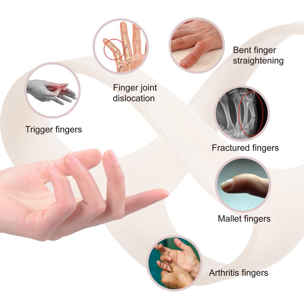 Buy now Oval Finger Splint 8 pcs, Finger Splints for Arthritis, Mallet Finger, Trigger Finger Splint, hypermobility(EDS) finger For Thumb/Middle,/Index/Pinky or Ring Finger(2,3,4,5,6,7,8,9) at indiglob india
