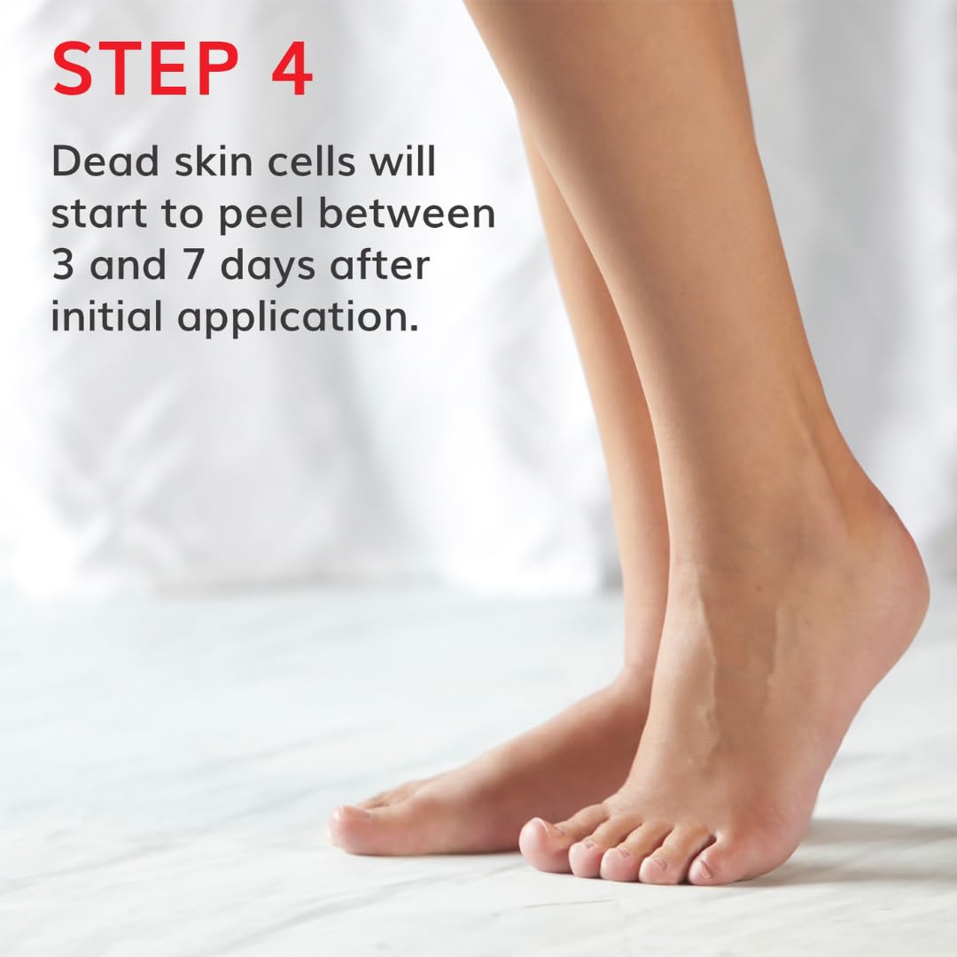 Baby Foot Original Exfoliation Foot Peel - For Rough Cracked, Dry Feet, Dead Skin Removal - Foot Peeling Mask for Baby Soft Feet - Spa Experience at Home & Gift Ideas - Lavender Scented