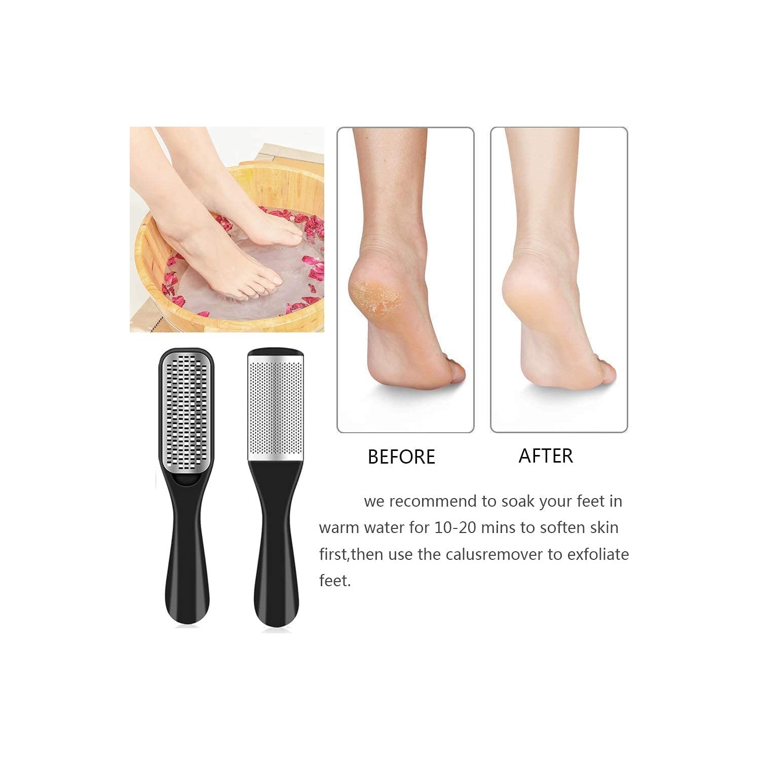 36 in 1 Pedicure Kit, Stainless Steel Foot Care Kit with Foot File | Professional pedicure kit with foot file, foot rasp, callus remover, nail clipper and cuticle pusher for home spa care.
