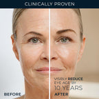 Buy now RoC Retinol Correxion Under Eye Cream for Dark Circles & Puffiness, Daily Wrinkle Cream, Anti Aging Skin Care Treatment Women and Men, 0.5 oz (Packaging May Vary) at indiglob india