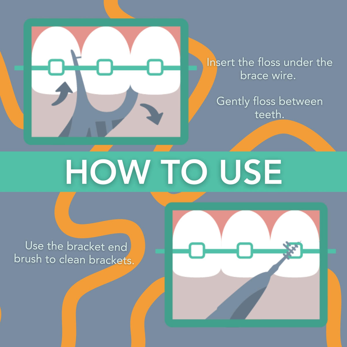 Floss Picks for Braces, 200 Count – Flossers with Slim Threader & Bracket Brush – Easy Daily Oral Care for Braces